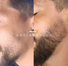 Charger l'image dans la galerie, REGENX - Repousse Naturelle de la Barbe