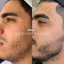 Charger l'image dans la galerie, REGENX - Repousse Naturelle de la Barbe