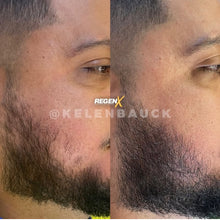 Charger l'image dans la galerie, REGENX - Repousse Naturelle de la Barbe