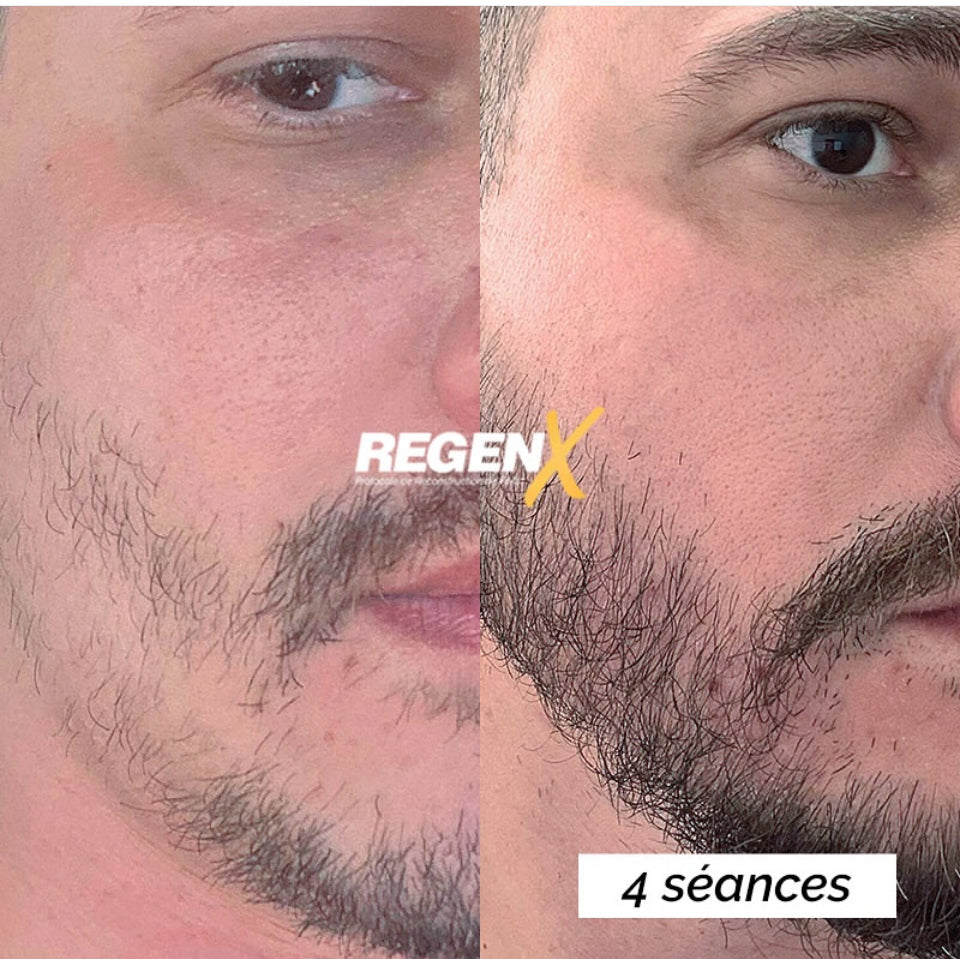 REGENX - Repousse Naturelle de la Barbe