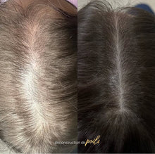 Charger l'image dans la galerie, REGENX - Repousse Naturelle des Cheveux