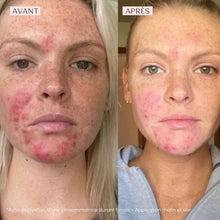 Charger l'image dans la galerie, YONKA - Crème 15 50 ml - crème anti imperfections assainissante et apaisante