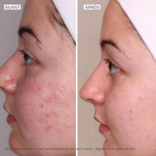 Charger l'image dans la galerie, YONKA - Crème PG - actions purifiante et matifiante - 50 ml