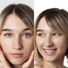 Charger l'image dans la galerie, Soin HYDRA FACIAL 1 heure - innovation rénovateur de peau