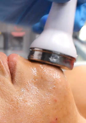 Soin HYDRA FACIAL 1 heure - innovation rénovateur de peau