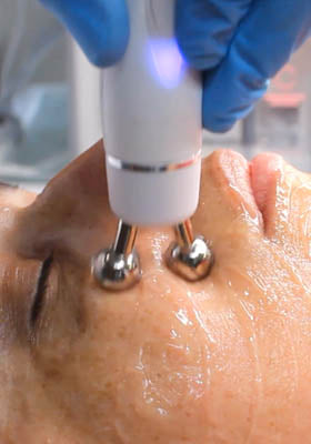 Soin HYDRA FACIAL 1 heure - innovation rénovateur de peau