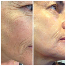 Charger l'image dans la galerie, Soins Anti-Âge la Fontaine - taches, cicatrices, rides