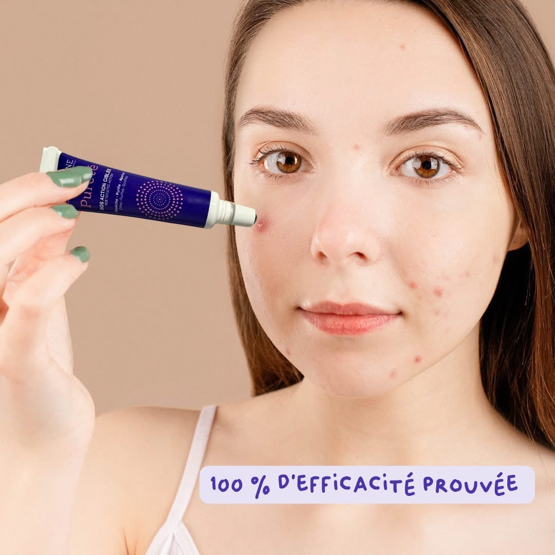 NOUGATINE – SOS Pureté Action Ciblée | Soin Anti-Boutons Préados 10 ml