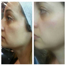 Charger l'image dans la galerie, Soin anti-âge WISH PRO résultats spectaculaires Beauvais