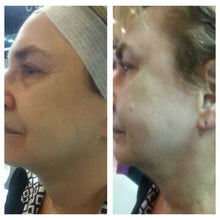 Charger l'image dans la galerie, Soin anti-âge WISH PRO résultats spectaculaires Beauvais