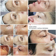 Charger l'image dans la galerie, Soin anti-âge WISH PRO résultats spectaculaires Beauvais