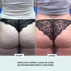 DLAB - Programme Brûle-Graisses cure 28 jours