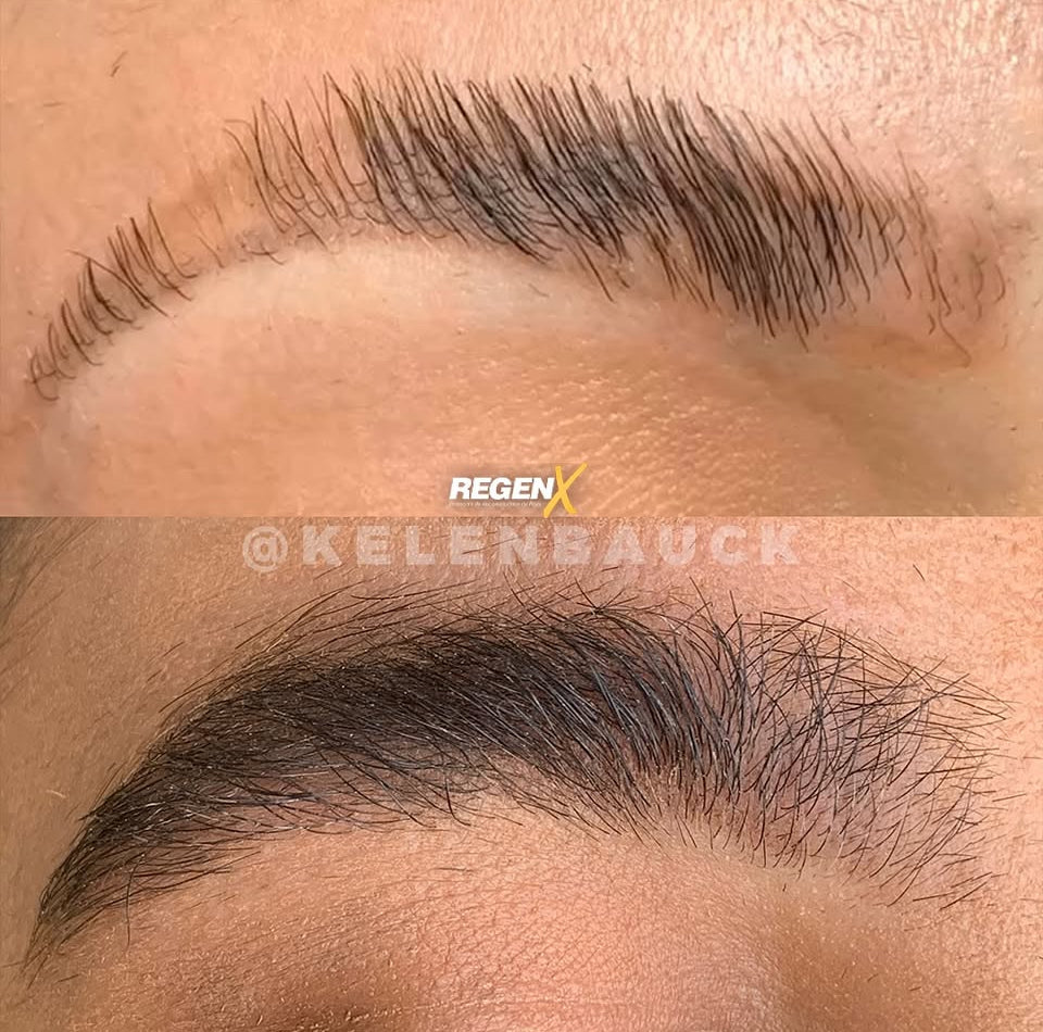 REGENX - Repousse Naturelle des Sourcils