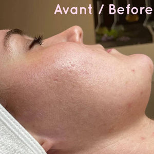 YONKA - Alpha Fluid + Alpha Peel - Programme Rénovateur de Peau