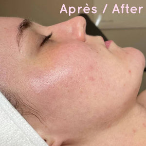 YONKA - Alpha Fluid + Alpha Peel - Programme Rénovateur de Peau