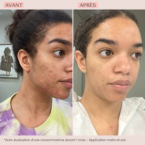 GLYCONIGHT - YonKa - 50 ml - Masque Peeling Lissant Effet peau neuve
