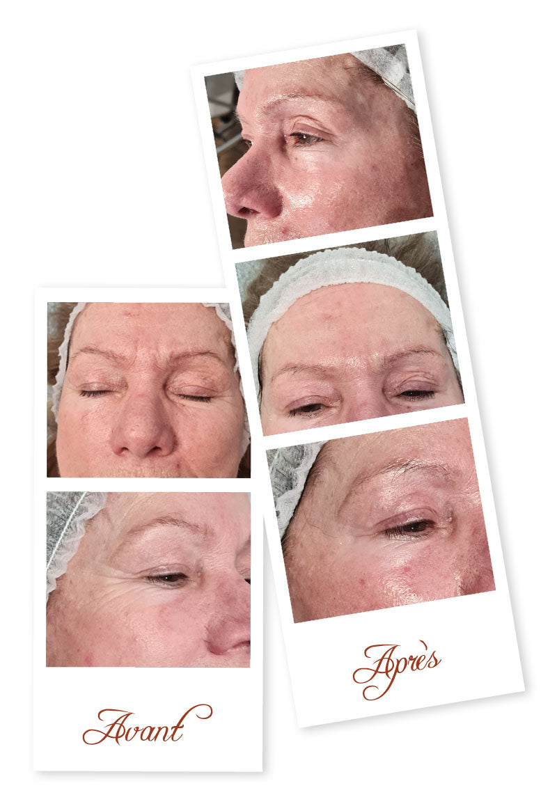 Soin du Visage Combleur aux fils tenseurs de Collagène - 1 heure
