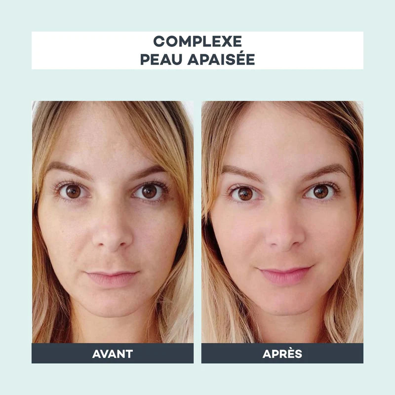 COMPLEXE PEAU APAISEE - DLAB 1 MOIS