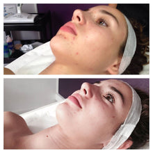 Charger l&#39;image dans la galerie, Soin anti-âge WISH PRO résultats spectaculaires Beauvais 
