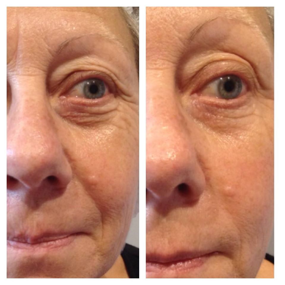 Soin anti-âge WISH PRO résultats spectaculaires Beauvais 