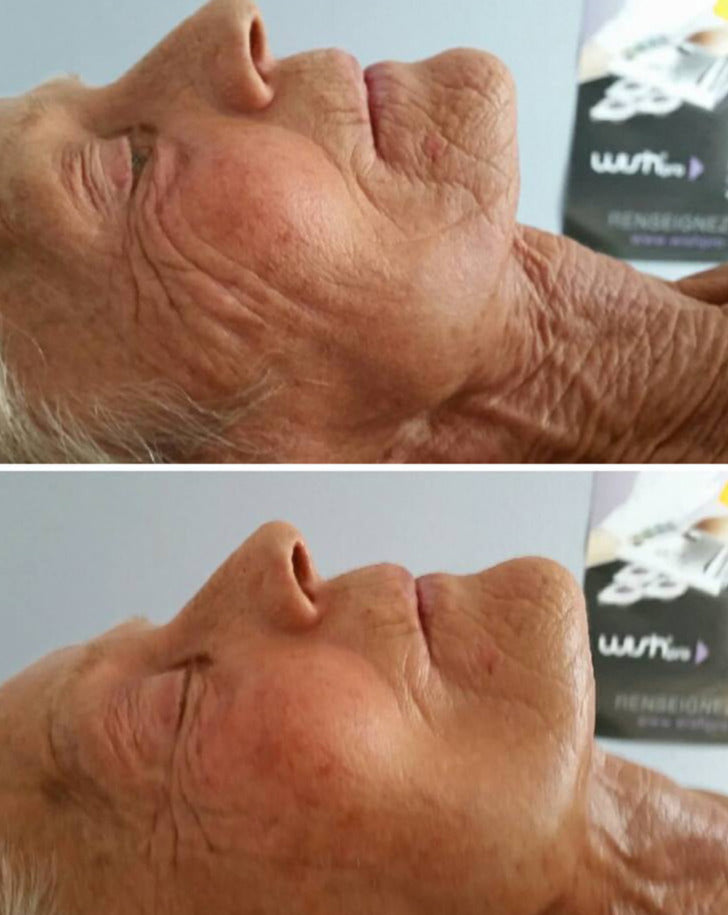 Soin anti-âge WISH PRO résultats spectaculaires Beauvais 